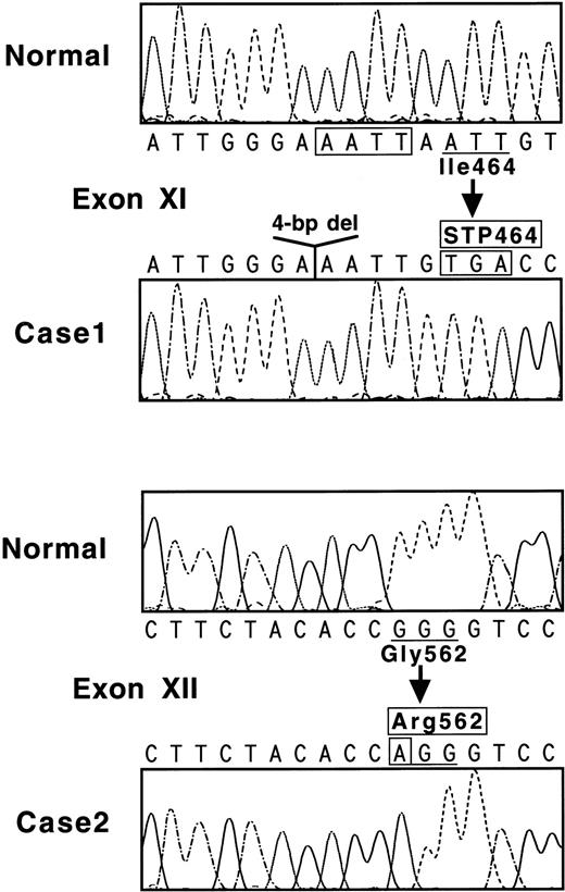 Fig. 2. (Top) Nucleotide sequence of a part of exon XI for normal and case no. 1. The 4-bp deletion is boxed. Codon 464 becomes a termination signal because of a reading frame-shift. (Bottom) Nucleotide sequence of a part of exon XII for normal and case no. 2. Mutated nucleotide A is indicated in a box, and a normal Gly562 residue is substituted with an abnormal Arg sequence.