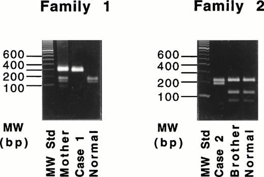 Fig. 3. Restriction digestion with Tru9I endonuclease of the amplified products of the exon XI for the 4-bp deletion (left) and with Hpa II endonuclease of the amplified products of exon XII for the Gly562-Arg mutation (right).