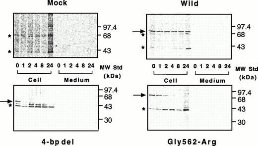 Fig. 7. Pulse-chase study of wild-type and mutant A subunits in BHK cells. Pulse-chase experiments were performed in a mammalian expression system as described in Materials and Methods. Radiolabeled cell lysates and culture media of cells were taken at various time intervals and immunoprecipitated with an antiserum against the A subunit, followed by electrophoresis on 10% SDS-polyacrylamide gels. Top left, mock; top right, wild-type; bottom left, the 4-bp deletion (4-bp del); bottom right, the Gly562-Arg mutant.