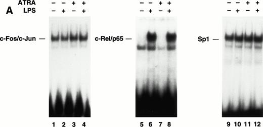 Fig. 6. The effect of ATRA on the binding of transcription factors to the TF promoter. (A) Effect of ATRA on the binding of c-Fos/c-Jun, Rel/p65, and Sp1. Nuclear extracts were isolated from THP-1 cells treated with or without ATRA (1 × 10−5 mol/L) for 30 minutes before the addition of LPS (10 μg/mL) for 2 hours. EMSAs were performed using AP-1, κB, and Sp1 sites. The position of c-Fos/c-Jun,c-Rel/p65, and Sp1 is indicated. Similar results were observed in an independent experiment. (B) Antibody supershift analysis of the protein-DNA complex formed using nuclear extracts from ATRA- and LPS-treated cells. Antibodies to various NF-κB proteins and Sp1 were incubated with nuclear extracts before the addition of a radiolabeled TF κB site.