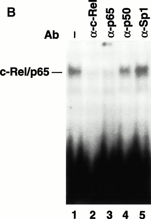 Fig. 6. The effect of ATRA on the binding of transcription factors to the TF promoter. (A) Effect of ATRA on the binding of c-Fos/c-Jun, Rel/p65, and Sp1. Nuclear extracts were isolated from THP-1 cells treated with or without ATRA (1 × 10−5 mol/L) for 30 minutes before the addition of LPS (10 μg/mL) for 2 hours. EMSAs were performed using AP-1, κB, and Sp1 sites. The position of c-Fos/c-Jun,c-Rel/p65, and Sp1 is indicated. Similar results were observed in an independent experiment. (B) Antibody supershift analysis of the protein-DNA complex formed using nuclear extracts from ATRA- and LPS-treated cells. Antibodies to various NF-κB proteins and Sp1 were incubated with nuclear extracts before the addition of a radiolabeled TF κB site.