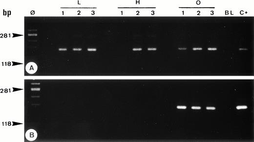 Fig. 6. Single-cell PCR analysis of the housekeeping genec-raf-1 (A) and the bcl-2/JH rearrangement (B) by seminested PCR analysis of cells isolated from frozen sections of OCI LY8 (lanes O: 1 through 3) and HSB-2 (lanes H: 1 through 3) tumor cells and of small lymphocytes from lymph node involved by HD (lanes L: 1 through 3). The amplified DNA was separated on 2% agarose/NuSieve gel electrophoresis and visualized by staining with ethidium bromide. Ø, molecular weight markers; BL (blank), PCR amplification without DNA template to rule out contamination; C+, positive control (OCI LY8 tumor DNA). C-raf-1 gene has been successfully amplified from 8 of 9 isolated single cells (A) as demonstrated by the presence of a band of 180 bp in 8 of 9 micromanipulated single-cell DNA, which indicates the validity of our methodology for the single-cell PCR amplification. As expected, only OCI LY8 tumor cells showed rearranged bcl-2/JH bands within the expected range of size (110 to 360 bp; lanes O: 1 through 3) (B).