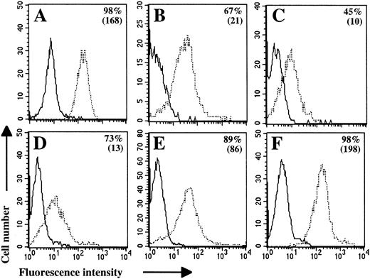 Fig. 1. CD95 molecule is expressed on freshly isolated lymphoma B cells. Flow cytometric analyses were performed on Jurkat cells (A), nontumoral B cells (B; Donor NT-1), and lymphoma B cells (C through F). Lymphoma B cells were obtained from LCL-1 (C), MCL-5 (D), FL-6 (E), and DLCL-4 (F) patients. Cells were stained with anti-CD95 MoAb CH-11 (dashed line) or with IgM control MoAb (solid line) followed by PE-conjugated antimouse IgM. Percentages of positive cells and MFI values (in brackets) are indicated for each cell population.