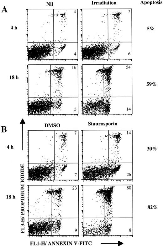 Fig. 5. Lymphoma B cells undergo apoptosis after irradiation or staurosporine treatment. Lymphoma cells (FL-2 patient) were cultured for 4 hours or 18 hours (A) without treatment or after irradiation (3,000 rads), (B) with 5 μmol/L staurosporine or dimethyl sulphoxide (DMSO) as a control. Cells were stained with annexin V-FITC/PI and then analyzed by flow cytometry. Numbers within dot plots represent the percentages of cells in early apoptosis (lower right, annexin V+/PI-) and in late apoptosis or in necrosis (upper right, annexin V±/PI+). Percentages next to the dot plots indicate the specific apoptosis.