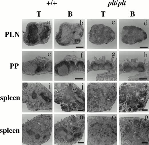 Fig. 1. Histological analysis of T and B cells in PLN, PP, and spleen in +/+ and plt/plt. PLN (a-d), PP (e-h) and spleens (i-l) were from DDD/1-+/+ and DDD/1-plt/plt. Spleens from BALB/c-+/+ (m,n) and BALB/c-plt/plt (o, p) were also examined. Cryostat section was treated sequentially with 30H12 (anti-Thy1.2) or RA3-3A1/6.1 (anti-B220) MoAb, biotinylated rabbit antirat IgG (Vector) polyclonal Ab, and horse radish peroxidase-conjugated streptavidin (Zymed), and visualized with 3, 3'-diaminobenzidine tetrahydrochloride (Dojindo). The sections were counterstained with Gill's hematoxylin (Polysciences) and photographed under a microscope. Bar indicates 400 μm.
