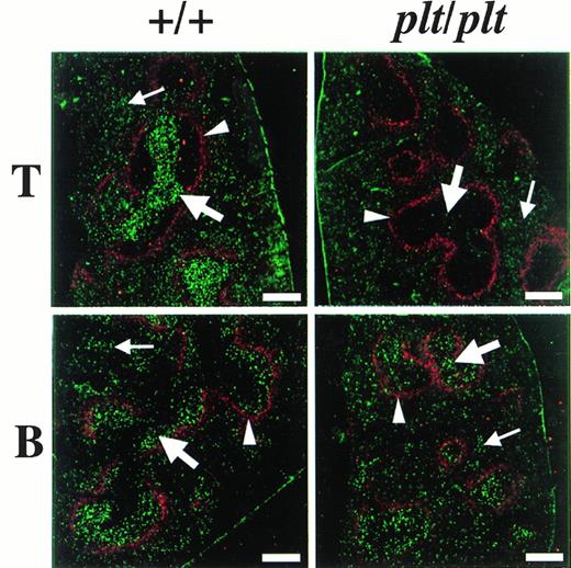 Fig. 4. Localization of T and B cells homing into spleen. T and B cells were enriched from spleen of DDD/1-+/+, labeled with BCECF-AM (Dojindo), and 5 × 107 of the cells were intravenously injected into DDD/1-+/+ and DDD/1-plt/plt. Spleens from recipients were frozen at 48 hours after the injection. Cryostat section of the spleen was stained with MOMA-1 MoAb (BMA Biomedicals Ltd) and Cy5-conjugated antirat IgG (Amersham) to identify MZM, then examined under a confocal laser microscope system (Bio-Rad). The region sorrounded by MZM (red, indicated by arrowheads) is white pulp. Injected T or B cells (green) were identified in white pulp (thick arrow) and in red pulp (thin arrow). Bar at the lower right corner indicates 250 μm.