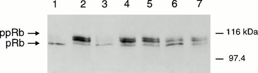 Fig. 2. Effect of MPA on pRb phosphorylation. Immunoblot analysis of pRb in resting peripheral blood T lymphocytes (lane 1), T lymphocytes stimulated with IL-2/PHA-L alone (lane 2) or in combination with 1 μmol/L MPA (lane 3), 1 μmol/L MPA plus 50 μmol/L guanosine and 100 μmol/L 8-aminoguanosine (lane 4), 250 μmol/L hydroxyurea (lane 5), 10 μmol/L ara-C (lane 6), and 1 μg/mL aphidicolin (lane 7). Cells were harvested after 24 hours of treatment and drugs were added at time 0.