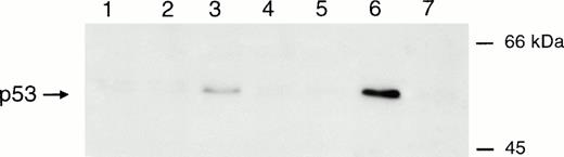 Fig. 5. Effect of MPA on p53 expression. p53 immunoblot analysis of isolated peripheral blood T lymphocytes in the resting state (lane 1), or after stimulation with IL-2/PHA-L alone (lane 2) or in combination with 1 μmol/L MPA (lane 3), 1 μmol/L MPA, 50 μmol/L guanosine and 100 μmol/L 8-aminoguanosine (lane 4), 250 μmol/L hydroxyurea (lane 5), 10 μmol/L ara-C (lane 6), and 1 μg/mL aphidicolin (lane 7). Cells were harvested after 24 hours of treatment.