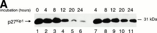 Fig. 6. Effect of MPA on p27Kip1 expression. (A) Western blot analysis of lysates immunoprecipitated with p27Kip1 antibody and detected with the same p27Kip1 antibody. Resting T lymphocytes (lane 1) were stimulated by the addition of IL-2/PHA-L in absence (lanes 2 to 6) or presence (lanes 7 to 11) of 1 μmol/L MPA for 4, 8, 12, 20, and 24 hours. (B) Western blot analysis of lysates immunoprecipitated with p27Kip1 antibody and probed with CDK2 antibody. T lymphocytes were stimulated with IL-2/PHA for 24 and 48 hours in absence (lanes 1 to 6) or presence of 1 μmol/L MPA (lanes 7 to 10).