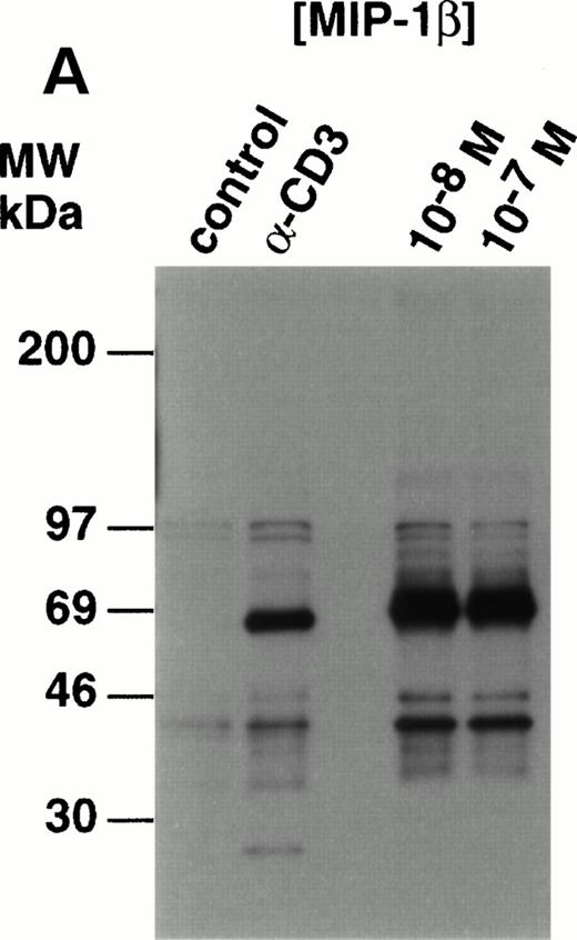 Fig. 3. Analysis of tyrosine phosphorylated proteins in thymocytes in response to MIP-1β. (A) Freshly-isolated unfractionated thymocytes were kept on ice before stimulation wth 10 nmol/L and 100 nmol/L MIP-1β, or anti-CD3 as a control, for 3 minutes at 37°C. After stimulation, the lysates were prepared as described in the Materials and Methods section. Electrophoresis under reducing conditions was performed using 12% tris-glycine gels and Western blots probed with antiphosphotyrosine (clone 4G10). (B) Thymocytes were purified and stimulated with anti-CD3 (10 mg) or 100 nmol/L MIP-1β as outlined in the Materials and Methods section. Electrophoresis under reducing condition was performed using 10% tris-glycine gels and Western blots probed with antiactive MAPK. Blots were stripped and reprobed with anti-ERK2 (lower panel) to show equivalent loading.