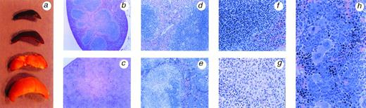 Fig. 1. BCG infection of IFN-γ −/− causes profound changes in the spleen. (A) Spleens isolated from infected IFN-γ +/+ (top two spleens) or IFN-γ −/− (bottom two spleens) mice 5 weeks after IP administration of BCG show the change in size and color of the organs. Low power view of spleens sections from IFN-γ +/+ (B) or IFN-γ −/− (C) mice. Note that the overall structure of the red and white pulp is intact in IFN-γ +/+ mice, but the normal architecture of infected IFN-γ −/− is completely effaced (photographed using a 10X objective). Higher power views of the spleen show that the white pulp of infected IFN-γ −/− mice is extensively infiltrated by macrophages (E and G), while infected IFN-γ +/+ mice retain the normal arrangement and cellular makeup of the white pulp (D and F). Note that in (E), a small area of lymphocytes remains in the right-hand portion of the white pulp. Lymphocytes gradually disappeared from the spleen. Magnifications: (D) and (E) (20X objective); (F) and (G) (40X objective). The red pulp of infected IFN-γ −/− mice was infiltrated with extramedullary hematopoietic tissue (H). Note the presence of nucleated erythroid cells, cells of the granulocytic series, and megakaryocytes (40X objective). All sections were stained with hematoxylin and eosin (H&E).