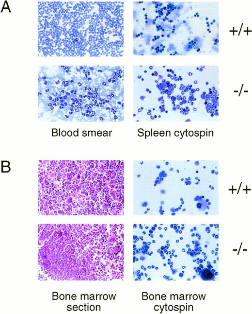 Fig. 3. Neutrophilia in the blood, spleen, and bone marrow of infected IFN-γ −/− mice. (A) Peripheral blood (left panels) or spleen cytospins (right panels) from infected IFN-γ +/+ or IFN-γ −/− mice (indicated at right) were stained with leukostat. Note that in the peripheral blood of IFN-γ −/− mice there are large numbers of mature neutrophils as well as less mature band forms and numerous monocytes in this smear (WBC of this mouse was 1.5 × 105/mL). The spleen of IFN-γ −/− also shows cells predominantly of the granulocyte series of various stages of maturity. All figures were photographed through a 40X objective). (B) Bone marrow sections (left panels) or bone marrow cytospins (right panels) from infected IFN-γ +/+ or IFN-γ −/− mice (indicated at right) were stained with H&E (sections) or leukostat (cytospins). The bone marrow of infected IFN-γ +/+ mice displays normal cellularity and populations of the various cell types. The marrow of IFN-γ −/− mice has large foci of granulocyte development and the cell types are largely band forms. Sections were photographed with a 20X objective and cytospins with a 40X objective.