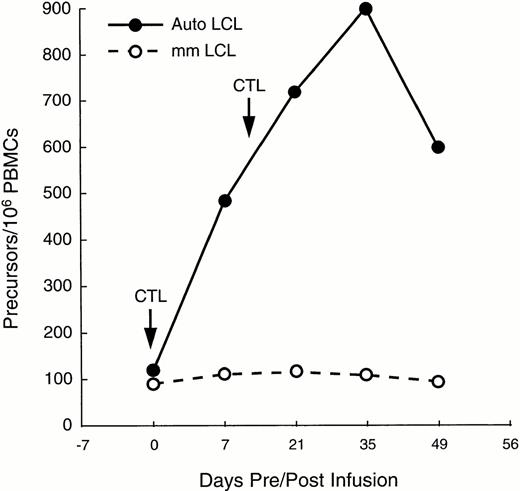 Fig. 4. Increase in EBV-specific CTL precursors after two infusions of CTL in a patient with relapsed Hodgkin's disease (—). CTL precursor frequencies (per 106 PBMC) were measured immediately before and for as long as 49 days after the infusion of the T cell lines. Frequency of precursors specific for autologous LCL increased by 10-fold. However, proportion of precursors able to kill allogeneic LCL changed only minimally, indicating that the observed increment in cytotoxicity was due to activity of “classical” CTL, rather than to MHC-unrestricted killer cells (---).