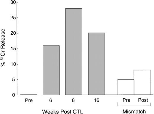 Fig. 5. Increased anti-EBV activity after CTL infusion. Immediately before and at 6, 8, and 16 weeks after the first infusion of CTL, cytotoxic T-cell lines were generated from the PBMC of a patient with relapsed Hodgkin's disease by culturing the cells with autologous LCLs (see Methods). The data, presented as percentage of51Cr release from autologous LCLs at an effector:target ratio of 20:1, demonstrate a maximum 28-fold rise in anti-EBV activity following CTL infusion (▪). There was no significant increase in MHC-unrestricted activated killer activity as demonstrated by there being no increase in the percentage of 51Cr release from HLA-mismatched LCL targets (□).