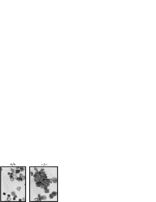 Fig. 2. The absence of IL-2 causes an accumulation of immature myeloid cells in the bone marrow of IL-2−/− mice. Cytocentrifuge preparations of bone marrow cells (BM) from 6-week old SPF wild-type (+/+) and IL-2−/− (×/×) mice were fixed and stained with Wright-Giemsa stain before photomicroscopy. Magnification 800X. The results shown are representative of 10 groups of mice.