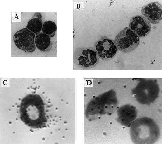 Fig. 8. Expression of IL-2Rβ mRNA and protein by immature cells of the myeloid lineage. The appearance of Mac-1loIL-2Rβ+ (A) and Mac-1hiIL-2Rβ+ (B) bone marrow cells isolated by FACS. The identity of bone marrow cells expressing the gene encoding the β-chain of the IL-2R (C and D) was determined by hybridization in situ of 35S-labeled probes synthesized in the antisense (C) or sense (D) orientation to cytocentrifuge preparations of total bone marrow from adult SCID mice. All cytocentrifuge preparations were fixed and stained with Wright-Giemsa stain before photomicroscopy. Magnification in A 800X and B through D 1000X. The results shown are representative of four independent experiments.