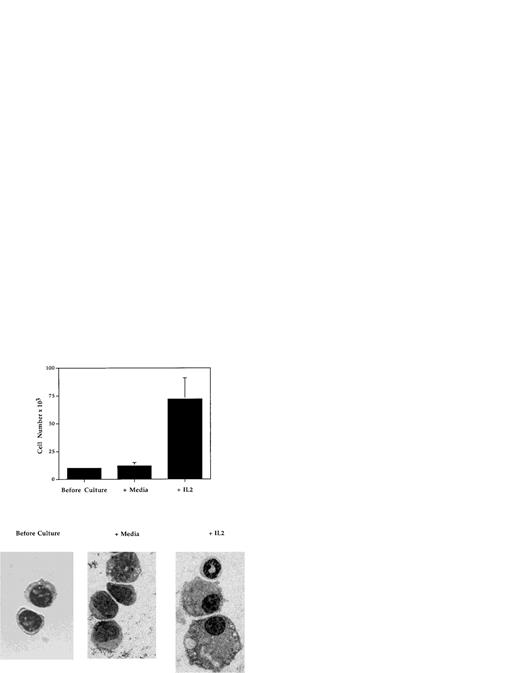 Fig. 9. IL-2 promotes the growth and differentiation of immature myeloid cells. FACS-isolated Mac-1loIL-2Rβ+bone marrow cells (before culture) were cultured for 7 days in complete media in the absence (media) or presence (+IL-2) of 100 U/mL of IL-2 after which the cells were harvested, counted, and cytocentrifuge preparations made. Upper panel: addition of IL-2 resulted in significant increase in the number of cells recovered at the end of culture (P < .001). Lower panel: cytocentrifuge preparations of Mac-1loIL-2Rβ+ cells before (before culture) and 7 days after culture in the absence (media) or presence (+IL-2) of IL-2. In the presence of IL-2, Mac-1loIL-2Rβ+ cells give rise to macrophages as well as mature granulocytes. Magnification 1,000X. The results are representative of three independent experiments.