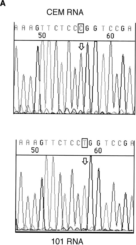 Fig. 2. Sequencing of RT-PCR products from samples withWT1 mutations and normal CEM cells. (A) 101 showing expression of only the mutant allele, T (boxed), compared with the wild-type sequence, (C) in CEM. (B) Reverse sequencing of 146 showing expression of wild-type and mutant alleles. Coding sequence is shown 3′ to 5′ above the reverse sequence, with the mutated T in bold.