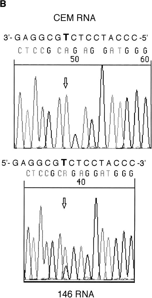 Fig. 2. Sequencing of RT-PCR products from samples withWT1 mutations and normal CEM cells. (A) 101 showing expression of only the mutant allele, T (boxed), compared with the wild-type sequence, (C) in CEM. (B) Reverse sequencing of 146 showing expression of wild-type and mutant alleles. Coding sequence is shown 3′ to 5′ above the reverse sequence, with the mutated T in bold.