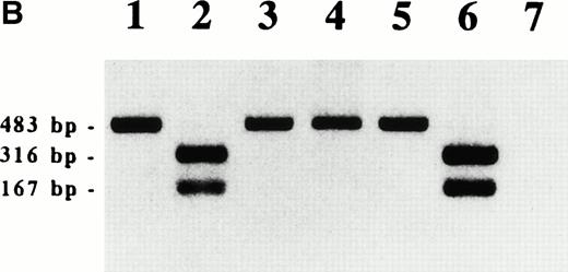 Fig. 2. WT1 expression in WT1-infected 32D clones. (A) Western blot analysis of WT1 protein. V4, V5, and V6 , empty vector-infected-32D clones; W2 , W3 , W4 , W10, and W12, wild-type WT1-infected 32D clones; Z5 and Z7, mutant WT1-infected 32D clones. (B) RT-PCR analysis of WT1 transcript. RT-PCR was performed as described previously.9 WT1 PCR products were digested with a restriction enzyme HaeIII and electrophoresed on a 1.5% agarose gel. Lane 1, K562 (a human leukemia cell line); lane 2, digestion of 1; lane 3, mouse kidney cells; lane 4, digestion of 3; lane 5, a WT1-infected 32D clone (W2); lane 6, digestion of 5; lane 7, an empty vector-infected 32D clone (V4).