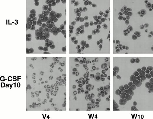 Fig. 4. Morphology of wild-type WT1-infected 32D clones cultured in IL-3– or G-CSF–containing medium. Cells maintained in rmIL-3 (50 U/mL)–containing medium (top) were washed for deprivation of IL-3, seeded in G-CSF (20 ng/mL)–containing medium, and cultured for 10 days (bottom). Cytospin cells were stained with May-Grünwald-Giemsa stain solution.