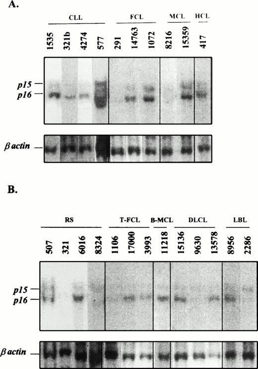 Fig. 1. Southern blot analysis of 10 indolent (A) and 13 aggressive (B) NHLs. The indolent lymphoid neoplasms 321b (CLL), 577 (CLL), and 291 (FCL) in A have their subsequent sample of the progressed lymphoma in B, cases 321 (Richter's syndrome), 8324 (Richter's syndrome), and 1106 (transformed FCL), respectively. Genomic DNA was digested with HindIII restriction enzyme and hybridized with the exon 2 of p16INK4a and β-actin probes. (A) Indolent lymphomas showed germline configuration except cases 291 (FCL) and 8216 (typical MCL), which had a homozygous deletion of the p16INK4a gene. (B) Analyses of transformed and aggressive variants of NHLs showed homozygous deletions of both p15INK4b and p16INK4a genes in cases 321 and 8324 (Richter's syndrome), 1106 (transformed FCL), and 9630 (diffuse LCL). Case 2286 (lymphoblastic lymphoma) showed a homozygous deletion of p16INK4a but no p15INK4b. The identification number of these cases is the same as that in Figs 2, 3, and 4.
