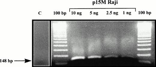 Fig. 2. Amplification with p15M primer pair of Raji cell line DNA, diluted in negative control DNA from a healthy volunteer. C, amplification with p15 primer pair of a control DNA from a healthy volunteer.