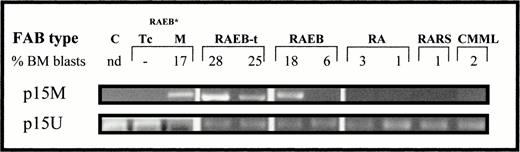 Fig. 3. Amplification of DNA from several MDS cases with p15M or p15U primer pair and from T (Tc) and mononuclear bone marrow (BM) cells isolated from a RAEB case*.
