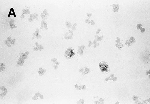 Fig. 1. Visualization of sPLA2 in (A) human granulocytes and (B) purified eosinophils. Granulocytes (containing 5% eosinophils) and purified eosinophils were centrifuged on microscope slides, and sPLA2 was detected by immunohistochemical staining with MoAb 4A1 as described in Materials and Methods.