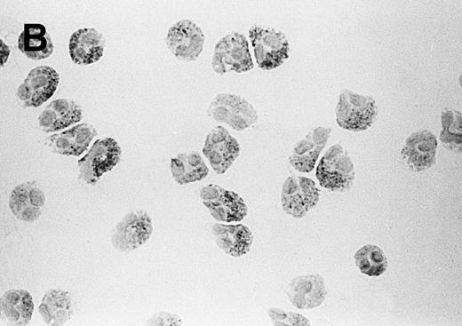 Fig. 1. Visualization of sPLA2 in (A) human granulocytes and (B) purified eosinophils. Granulocytes (containing 5% eosinophils) and purified eosinophils were centrifuged on microscope slides, and sPLA2 was detected by immunohistochemical staining with MoAb 4A1 as described in Materials and Methods.