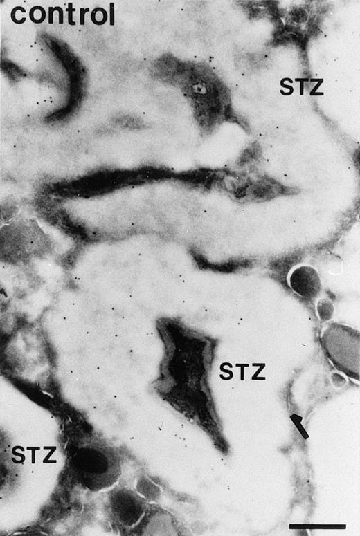 Fig. 3. Localization of sPLA2 in human eosinophils after incubation of the cells with STZ for 10 minutes. (A) Ultrathin cryosections were incubated as described in the legend to Fig 2. The micrograph shows several STZ particles contained in a phagosome that are strongly labeled for sPLA2. Nucleus (n); bar = 500 nm. (B) Micrograph showing some aspecific labeling of the STZ-treated eosinophils incubated with rabbit antimouse IgG and goat antirabbit IgG conjugated to 10-nm gold particles. Some specific granules (g) are seen near the phagosomes. Bar = 500 nm.