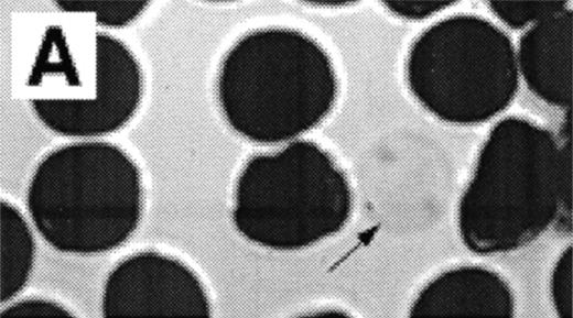 Fig. 3. Analysis of RBCs incubated with FITC-labeled AV after treatment with calcium in the presence of 4 μmol/L ionophore A23187 by fluorescence microscopy. (A) A representative field of this population as observed in bright field and (B) in fluorescence; note the RBC ghost indicated by arrow. (C) A calcium ionophore scrambled spherocytic red cell analyzed by serial optical sections in confocal fluorescent microscopy.