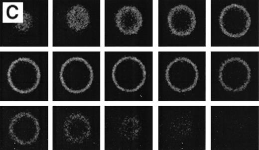 Fig. 3. Analysis of RBCs incubated with FITC-labeled AV after treatment with calcium in the presence of 4 μmol/L ionophore A23187 by fluorescence microscopy. (A) A representative field of this population as observed in bright field and (B) in fluorescence; note the RBC ghost indicated by arrow. (C) A calcium ionophore scrambled spherocytic red cell analyzed by serial optical sections in confocal fluorescent microscopy.