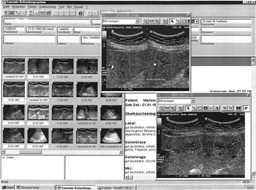 Fig. 1. The ultrasound pictures of this patient show a nonresponse to antifungal therapy in the course of chronic systemic candidiasis. The micro-abscesses in the left lobe of the liver are documented to be nonresponding. All stored ultrasound pictures, in part demonstrated on the left side of the computer screen, can be enlarged for comparison.