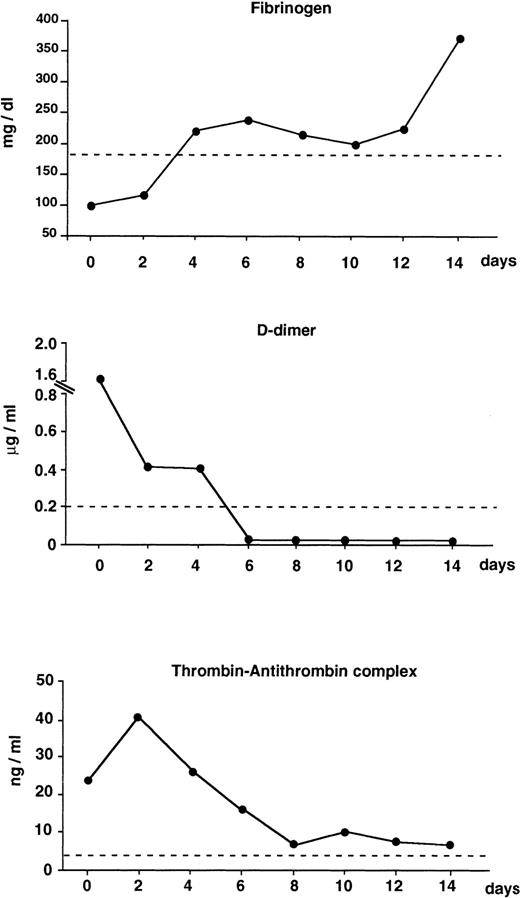Fig. 1. Changes of coagulation markers in newly diagnosed APL patients (n = 9) receiving ATRA for induction therapy. Results are the median values of fibrinogen, D-dimer, and thrombin-antithrombin complex (TAT) at different intervals during the first 2 weeks of treatment. Dashed lines are: fibrinogen = the lower limit of normal control values; D-dimer and TAT = the mean + 2 SD (cut-off point) of normal control values. (Modified and reprinted with permission.15)