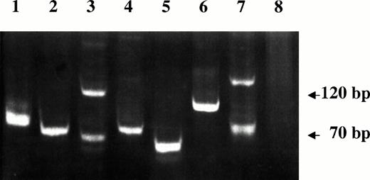 Fig. 3. VDJ-IgH PCR analysis of DNA samples from lymphoma tissues of SIV-infected monkeys. Lanes 1 through 4 are from monkeys 4, 208, OD5, and 8503, respectively. A spontaneous nasal non-Hodgkin's B-cell lymphoma from uninfected monkey (lane 5), Rajii cells (lane 6), SL-691, an in vitro established Simian Lymphoblastoid B-cell line (lane 7), and monkey PBMC (lane 8) were also included as controls.
