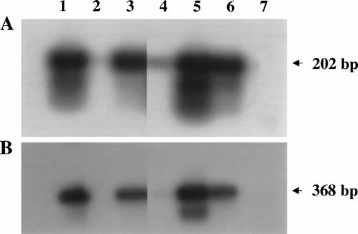 Fig. 4. PCR analysis of high-molecular-weight DNA extracted from lymphoma tissues of infected monkeys. Primers and probes amplifyinggag (A) and env (B) regions of the SIV genome were used as described in Materials and Methods. Lanes 1 through 5 are samples of monkeys 4, 208, OD5, 8503, and S1, respectively. DNA samples derived from SIV chronically infected HUT 78 cells (lane 6) or HUT 78 uninfected (lane 7) cells were included as positive or negative control, respectively.