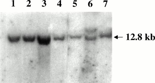 Fig. 5. Southern blot analysis of the c-myc locus in SIV-associated lymphomas. DNA samples were digested with EcoRI and hybridized with the pMC41-3DC probe covering the 3rd exon of thec-myc locus. Lanes 1 through 5 are samples of monkeys 4, 208, OD5, 8503, and S1, respectively. The Raji cells (lane 6) carrying the germ line band (12.8 Kd) and a higher rearranged band (<12.8 kd) and monkey PBMC (lane 7) were included as controls.