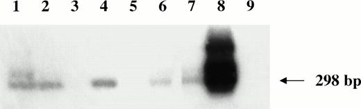 Fig. 6. Nested HVMF-1 DNA-PCR analysis of monkey lymphomas. Lanes 1 through 5 are samples of monkeys 4, 208, OD5, 8503, and S1, respectively. Furthermore, samples from a spontaneous nasal non-Hodgkin's B-cell lymphoma from uninfected monkey (lane 6), from SL-P1 and SL-691 cells (in vitro established Simian Lymphoblastoid cell lines; lane 7 and 8, respectively), and from HUT 78 human T-cell line (lane 9) were included as controls.