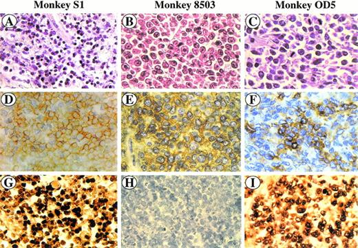 Fig. 1. SIV-associated lymphomas. Sections were stained with hematoxylin and eosin (A, B, and C), immunostained with anti-CD3 MoAb (D) and anti-CD20 MoAb (E, F), and hybridized with the SG5 SIV gag oligoprobe (G, H, I). Monkey S1 (A, D, and G) is a peripheral CD3+ T-cell lymphoma (D); CD3+ cells (yellow) show a positive in situ hybridization signal (brown) (G). Monkey 8503 (B, E, and H) is a centroblastic CD20+ B-cell lymphoma (E) showing a negative in situ hybridization signal (H). Monkey OD5 (C, F, and I) is a centroblastic CD20+ B-cell lymphoma (F) showing a positive in situ hybridization signal (I).