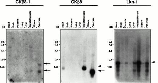 Fig. 5. Tissue distribution of Lkn-1, CKβ8-1, and CKβ8 mRNA. The human multiple tissue blot (first panel) was purchased from Clonetech. Each oligonucleotide probe (5 × 106 cpm/mL) was hybridized to the membrane at 45°C and finally washed with 2 × SSC at 45°C for 20 minutes. Indicated by arrows are CKβ8-1, CKβ8, and Lkn-1 mRNAs.