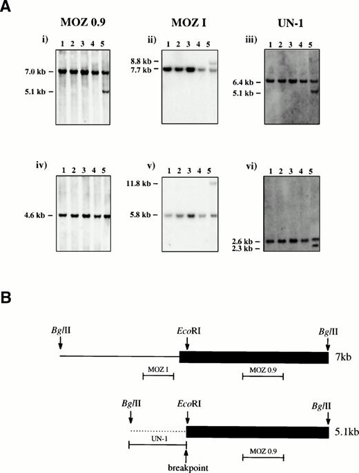 Fig. 1. (A) Southern Blot analysis. Genomic DNA from four controls (lanes 1-4) and the inv(8) patient (lane 5) were digested withBglII (i-iii) or EcoRI (iv-vi) and probed with MOZ 0.9, MOZ I, and UN-1 as indicated. Germline bands were present in all samples and an additional band was seen for the patient for all enzyme/probe combinations except EcoRI/MOZ 0.9. (B) Schematic representation of the two sequenced bacteriophage λ clones. The 7-kb and 5.1-kb BglII fragments were derived from the germline and rearranged bands, respectively. The last MOZ exon is shown as a filled box and intron sequence as a line. The positions of the probes MOZ 0.9, MOZ I, and UN-1 are indicated. The breakpoint in the 5.1-kb clone coincides with the EcoRI site within the last exon of MOZ, 47 bp downstream of the MOZ intron-exon junction.
