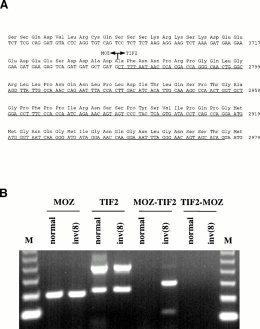 Fig. 3. (A) Sequence surrounding the MOZ-TIF2 fusion. Nucleotide 3745 of MOZ was joined to nucleotide 2768 ofTIF2. The underlined sequence indicates the region withinTIF2 that is alternatively spliced in both the normal and fusion genes. (B) RT-PCR analysis of bone marrow RNA from a normal individual and the patient with the inv(8). Normal MOZ andTIF2 transcripts were detected in both samples, the lowerTIF2 band resulting from alternative splicing. TheMOZ-TIF2 fusion was seen only in the patient and reciprocalTIF2-MOZ transcripts were not detected. The identity of all bands was confirmed by sequencing. M, 123-bp molecular weight marker.