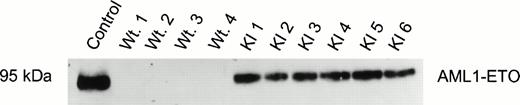 Fig. 4. AML1-ETO expression in the dysplastic hematopoietic cells. Western blot analysis of total cell lysates prepared from wild-type (Wt.) or AML1-ETO/+ knock-in (KI) cells. Cell lysates transferred to nitrocellulose membranes were blotted with affinity purified ETO N-terminal peptide antisera and visualized with supersignal ULTRA chemiluminescence substrate.