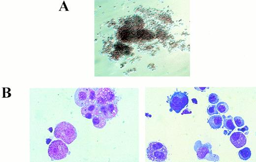 Fig. 3. Morphology of dysplastic AML1-ETO/+ mixed hematopoietic colonies. (A) Abnormal mixed colonies derived fromAML1-ETO/+ fetal liver cells. (B) Cytocentrifuge preparations of cells contained within these colonies. (Left) Numerous hypergranular myeloid cells are seen with frequent abnormal binucleated and trinucleated cells detected. (Right) Illustration of the mixed nature of the colony with maturing erythroid cells, a monocyte, binucleated myeloid precursors, and a dysplastic megakaryoblast.