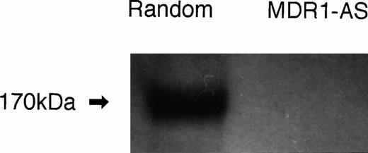Fig. 2. P-gp expression after random- or MDR1-AS treatment (5 μmol/L) in K562/ADM cells. Western blot analysis using C219 monoclonal antibody was performed.