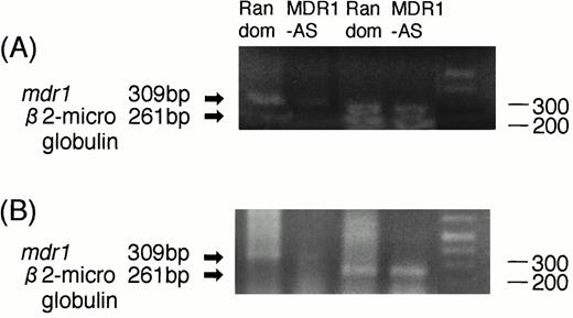 Fig. 7. (A) Expression of mdr1 mRNA on AML blast cells (Case No. 9) after random or MDR1-AS treatment (2.5 μmol/L) by RT-PCR analysis. The ratio ofmdr1/β2-microglobulin in random- and MDR1-AS–treated groups analyzed by scanning densitometry were 2.06 and 0.55, respectively. (B) Expression of mdr1 mRNA of cells from pooled colonies produced by AML blast cells (Case No. 9) treated with random or MDR1-AS oligonucleotide by RT-PCR analysis. The ratio ofmdr1/β2-microglobulin in random- and MDR1-AS–treated groups analyzed by scanning densitometry were 0.93 and 0.58, respectively.