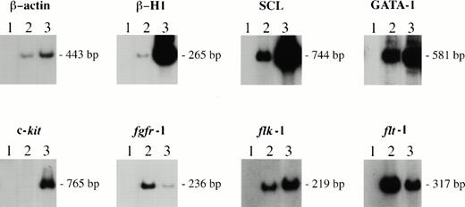 Fig. 3. Gene expression analysis using RT-PCR. Lanes 1, negative control; lanes 2, RNA from EB-PE cells grown in bFGF and Epo; lanes 3, RNA from EryP cells. EryP colonies were obtained by replating day 4 EB cells into methylcellulose cultures with Epo. The resulting EryP colonies were pooled and RNA was extracted. The amplified DNA sizes are indicated on the right. β-actin is shown as a control.