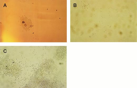 Fig. 3. Single cells of CD34+38+DR+ and CD34+38−DR+ phenotypes were deposited into single U-shaped wells into serum-free medium and standard growth factors. The wells had been precoated with H120, H0, or BSA or left uncoated. Wells were photographed at 1 and 2 weeks. (A) Proliferation from a CD34+38+DR+ cell at 1 week in a BSA-coated well. Cells are growing in the base of the well. (B) Proliferation from a CD34+38−DR+ cell at 1 week in a well coated with H120. Cells have migrated around and up the sides of the well. (C) Proliferation from a CD34+38+DR+ cell at 2 weeks in a well coated with H120. Cells have proliferated in focal sites around and up the sides of the well.