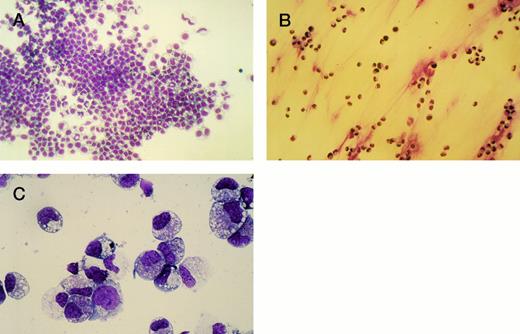 Fig. 6. (A) Adherent layer of cells in H120-coated wells stained in situ with May-Grünwald-Giemsa after removing cells in suspension. (B) Cells adherent to uncoated wells stained in situ with May-Grünwald-Giemsa after removal of suspension cells. (C) Photograph of cytospin of suspension cells stained with May-Grünwald-Giemsa. For differential cell count see text.